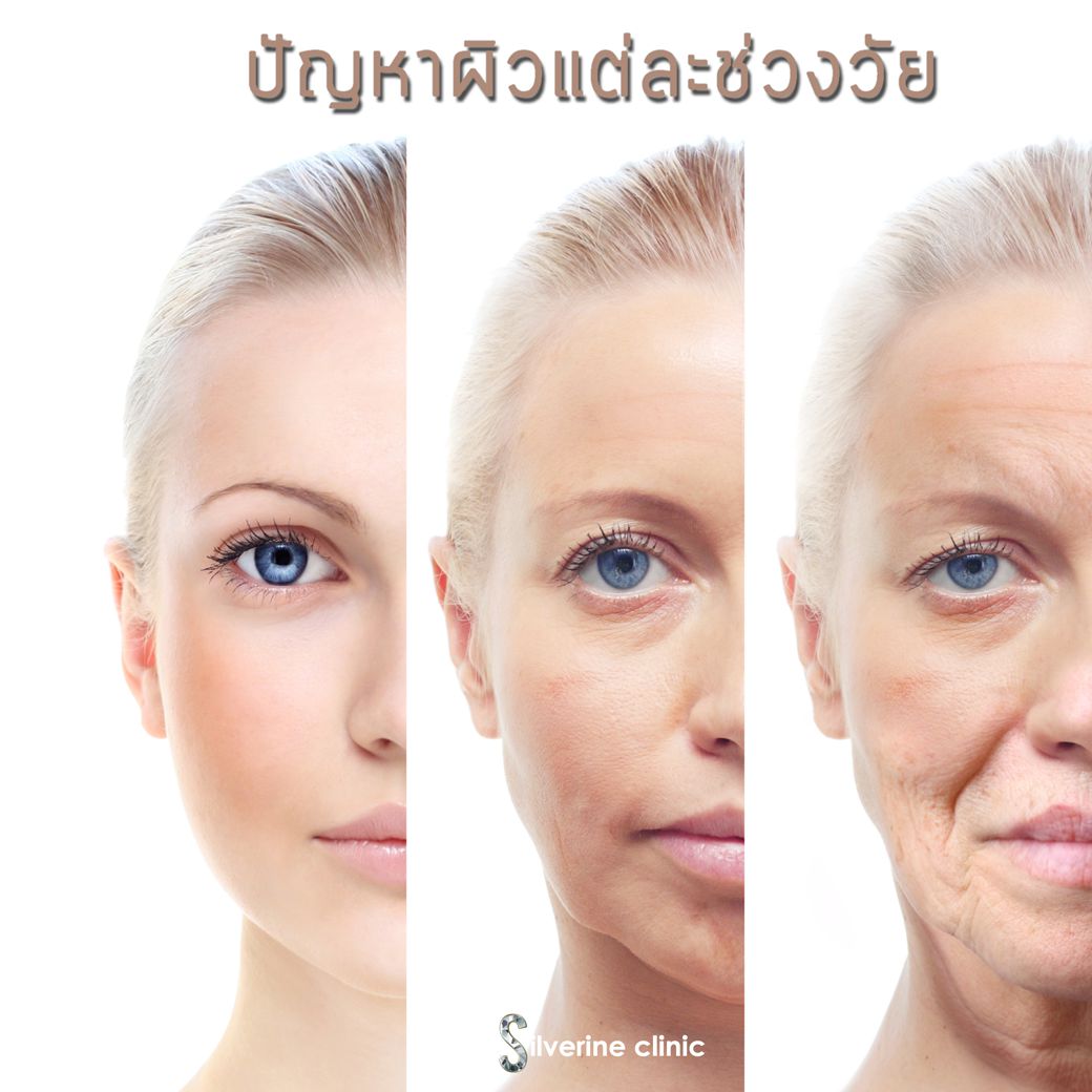 ปัญหาของผิวแต่ละช่วงวัยเป็นอย่างไร