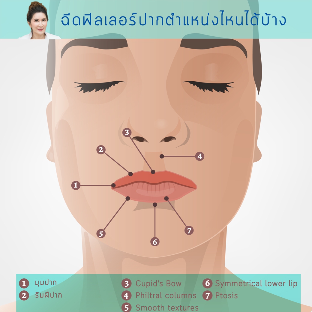 ฟิลเลอร์ปากต้องฉีดตรงไหนบ้าง ?