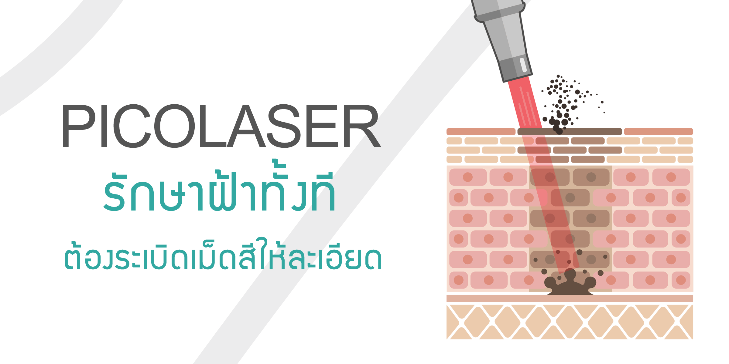 รักษาฝ้าด้วยเลเซอร์pico