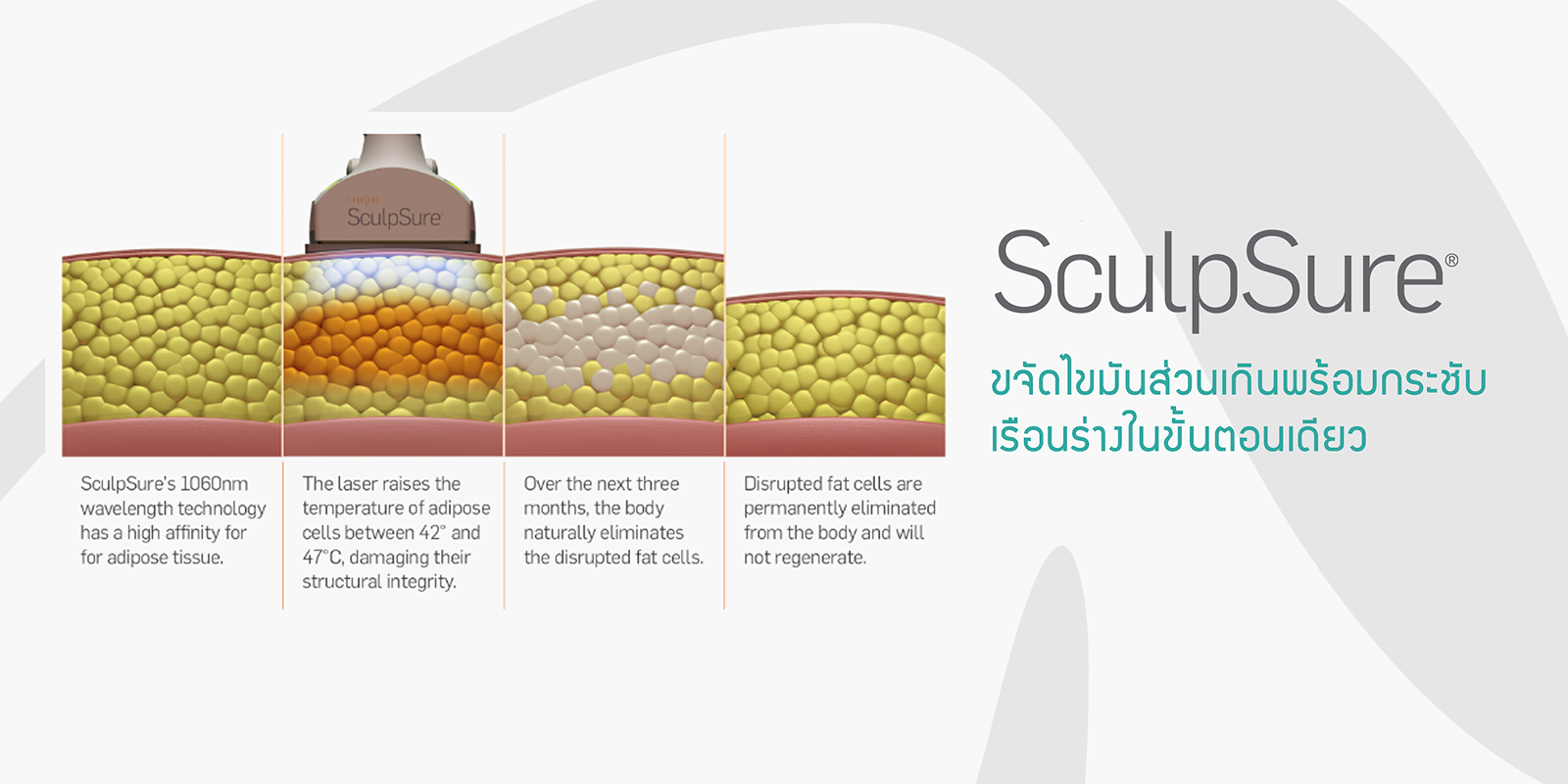 Sculpsure coolsculpting